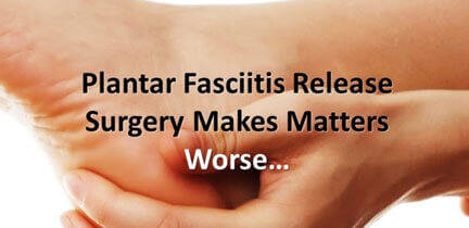 Plantar Fasciitis Surgery Types of Surgical