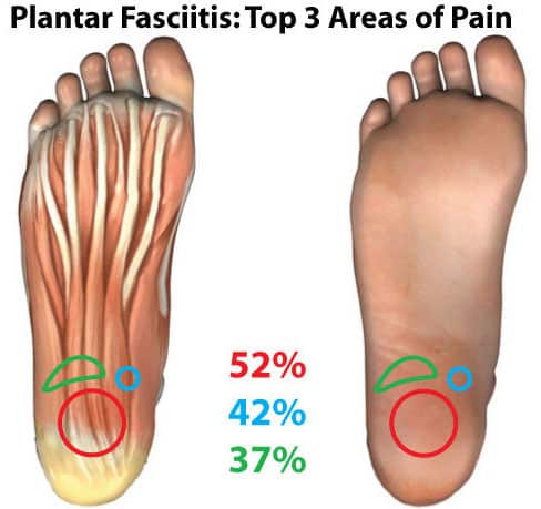 Ayurvedic Treatment for foot Pain, Sydney, Australia - Ayur Healthcare